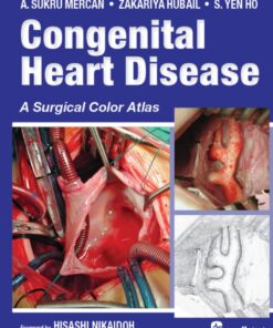 Congenital Heart Disease: A Surgical Color Atlas: A Surgical Color Atlas eBook