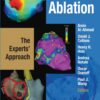 Hands-On Ablation: The Experts' Approach eBook