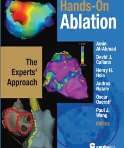 Hands-On Ablation: The Experts' Approach eBook