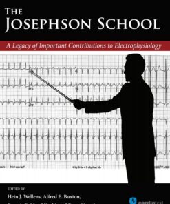 The Josephson School: A Legacy of Important Contributions to Electrophysiology 1st Edition A Legacy of Important Contributions to Electrophysiology eBook