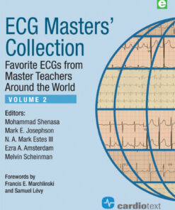 ECG Masters Collection Volume 2: Favorite ECGs from Master Teachers Around the World eBook