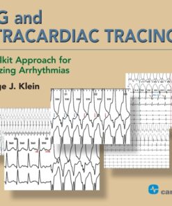 ECG and Intracardiac Tracings: A Toolkit Approach for Analyzing Arrhythmias eBook