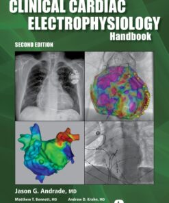 Clinical Cardiac Electrophysiology Handbook, Second Edition eBook