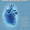 Workbook of Diagnostics for Cardiac Implantable Devices eBook