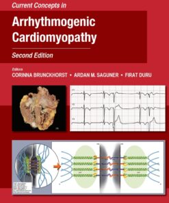 Current Concepts in Arrhythmogenic Cardiomyopathy, Second Edition eBook