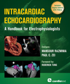 Intracardiac Echocardiography: A Handbook for Electrophysiologists eBook