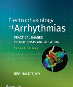 Electrophysiology of Arrhythmias: Practical Images for Diagnosis and Ablation eBook
