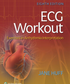ECG Workout: Exercises in Arrhythmia Interpretation eBook
