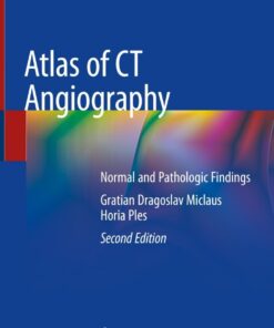 Atlas of CT Angiography: Normal and Pathologic Findings eBook