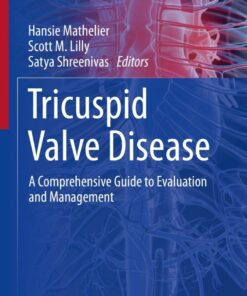 Tricuspid Valve Disease: A Comprehensive Guide to Evaluation and Management eBook