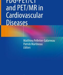 FDG-PET/CT and PET/MR in Cardiovascular Diseases eBook