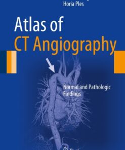 Atlas of CT Angiography: Normal and Pathologic Findings eBook