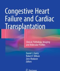 Congestive Heart Failure and Cardiac Transplantation: Clinical, Pathology, Imaging and Molecular Profiles eBook