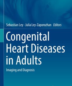 Congenital Heart Diseases in Adults: Imaging and Diagnosis eBook
