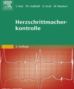Herzschrittmacherkontrolle eBook
