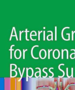 Arterial Grafting for Coronary Artery Bypass Surgery eBook