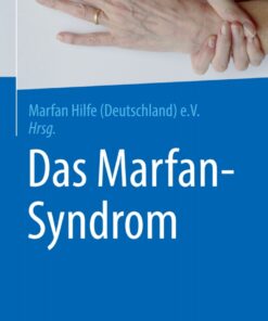 Das Marfan-Syndrom eBook