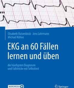 EKG an 60 Fällen lernen und üben: die häufigsten Diagnosen und Fallstricke mit Selbsttest eBook