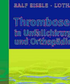Thromboseprophylaxe in Unfallchirurgie und Orthopädie eBook