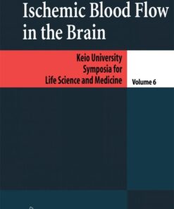 Ischemic Blood Flow in the Brain eBook