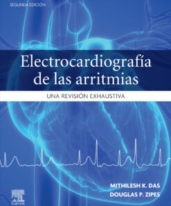 Electrocardiografía de las arritmias: Una revisión exhaustiva eBook