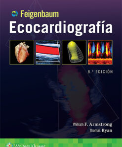Feigenbaum. Ecocardiografía eBook