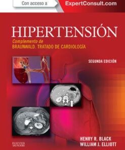 Hipertensión eBook