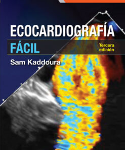 Ecocardiografía fácil eBook