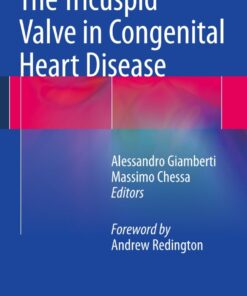 The Tricuspid Valve in Congenital Heart Disease eBook