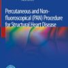 Percutaneous and Non-fluoroscopical (PAN) Procedure for Structural Heart Disease eBook