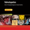 Valvulopatías eBook