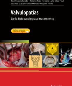 Valvulopatías eBook