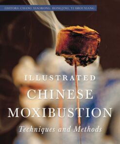 Illustrated Chinese Moxibustion Techniques and Methods eBook