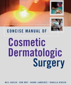 Concise Manual of Cosmetic Dermatologic Surgery eBook