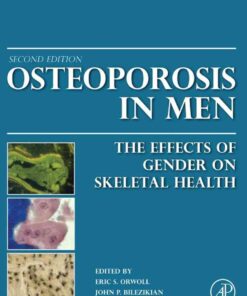 Osteoporosis in Men: The Effects of Gender on Skeletal Health eBook