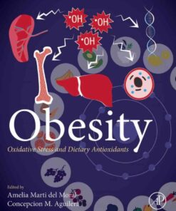 Obesity: Oxidative Stress and Dietary Antioxidants eBook