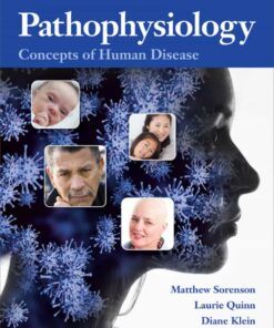 Pathophysiology: Concepts of Human Disease, 1st Edition eBook