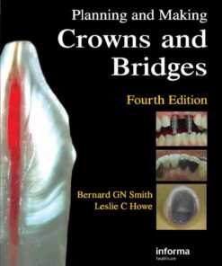Planning and Making Crowns and Bridges eBook