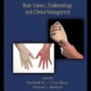 Latex Intolerance: Basic Science, Epidemiology, and Clinical Management eBook