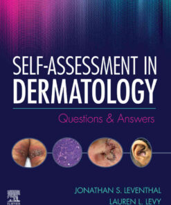 Self-Assessment in Dermatology: Questions and Answers eBook