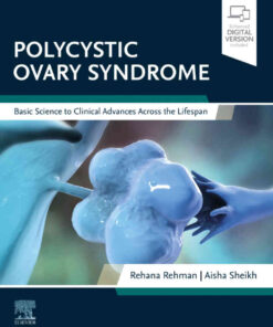 Polycystic Ovary Syndrome: Basic Science to Clinical Advances Across the Lifespan eBook