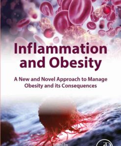 Inflammation and Obesity: A New and Novel Approach to Manage Obesity and its Consequences eBook