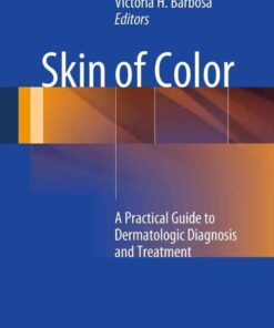 Skin of Color: A Practical Guide to Dermatologic Diagnosis and Treatment eBook