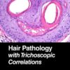 Hair Pathology with Trichoscopic Correlations eBook
