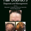 Hair Disorders: Diagnosis and Management eBook