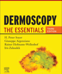 Dermoscopy: The Essentials eBook