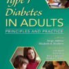 Type 1 Diabetes in Adults: Principles and Practice eBook