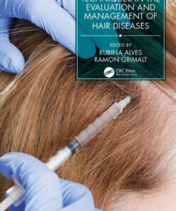 Techniques in the Evaluation and Management of Hair Diseases eBook