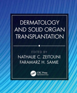 Dermatology and Solid Organ Transplantation eBook