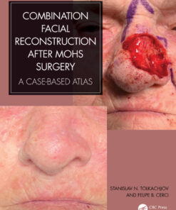 Combination Facial Reconstruction after Mohs Surgery: A Case Based Atlas eBook